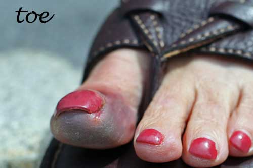 Toe